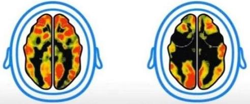 迷戀電視手機，孩子大腦會發(fā)生什么變化？幾組數據讓人觸目驚心